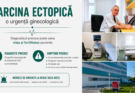 Sarcina ectopică poate fi o urgență medicală. Care sunt semnele de alarmă?